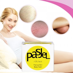 Pasjel new Arrival Effective AIVOYE stretch marks scar removal Cream slack line firming & lifting skin stretch mark repair cream